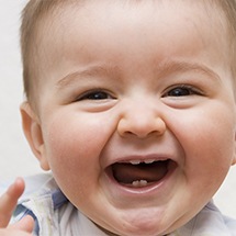 Crying baby before tongue tie treatment