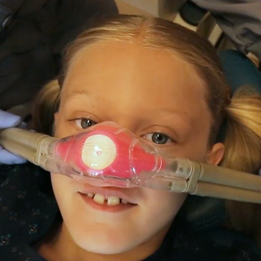 Child with nitrous oxide mask